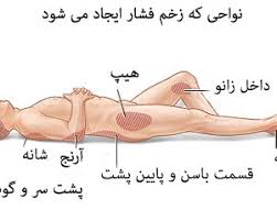 نواحی ایجاد زخم بستر