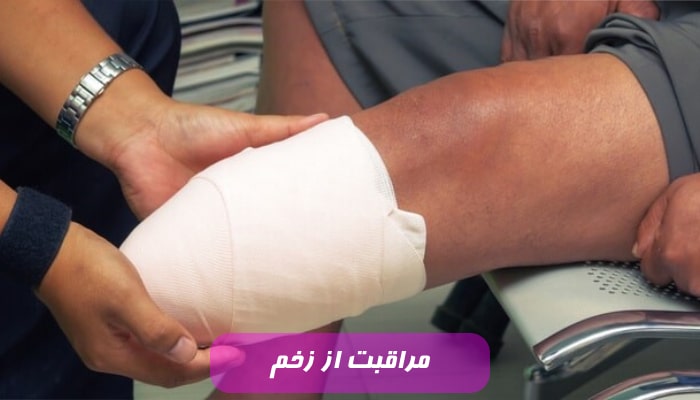 مراقبت از زخم