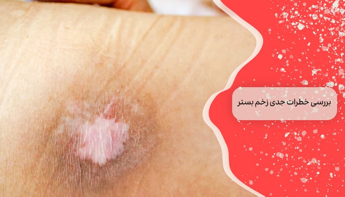 بررسی برخی از خطرات جدی زخم بستر