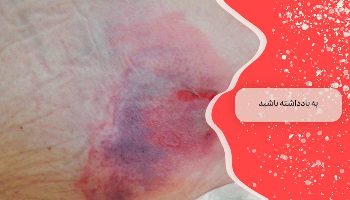 به یاد داشته باشید
