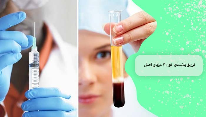 تزریق پلاسمای خون 3 مزایای اصلی 1 فرآیند تزریق پلاسمای خون