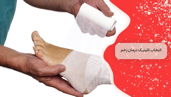 کلینیک درمان زخم 1 راه برای مراقبت و بهبود زخم ها 2 انتخاب کلینیک درمان زخم