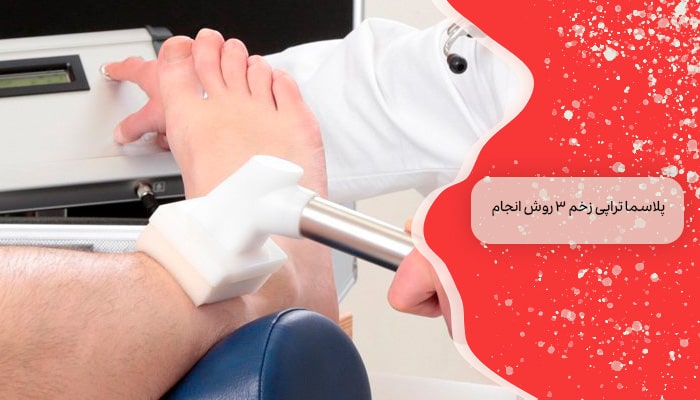پلاسما تراپی زخم 3 روش انجام 10 پلاسما تراپی زخم 3 روش انجام