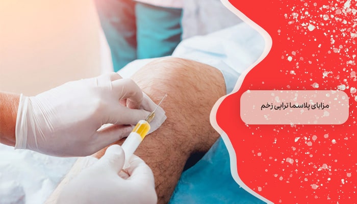 پلاسما تراپی زخم 3 روش انجام 2 مزایای پلاسما تراپی زخم