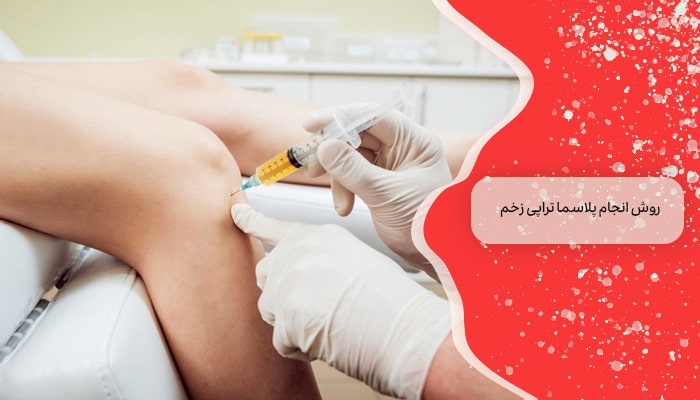 پلاسما تراپی زخم 3 روش انجام 1 روش انجام پلاسما تراپی زخم