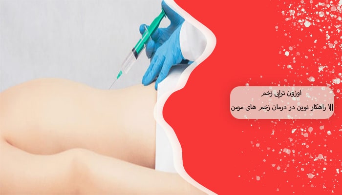 اوزون تراپی زخم 1 راهکار نوین در درمان زخم های مزمن 5 اوزون تراپی زخم 1 راهکار نوین در درمان زخم های مزمن