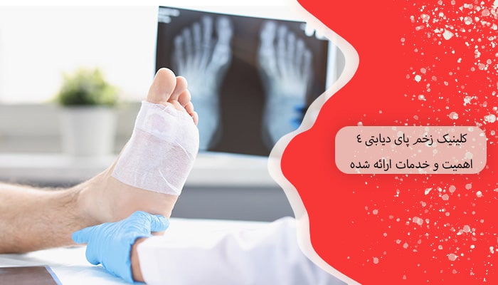کلینیک زخم پای دیابتی 4 اهمیت و خدمات ارائه شده 8 کلینیک زخم پای دیابتی 4 اهمیت و خدمات ارائه شده